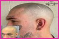 Unveiling The Truth: Steve Austin's Baldness Decoded